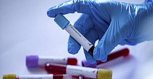Turkey: Death toll from coronavirus rises to 501